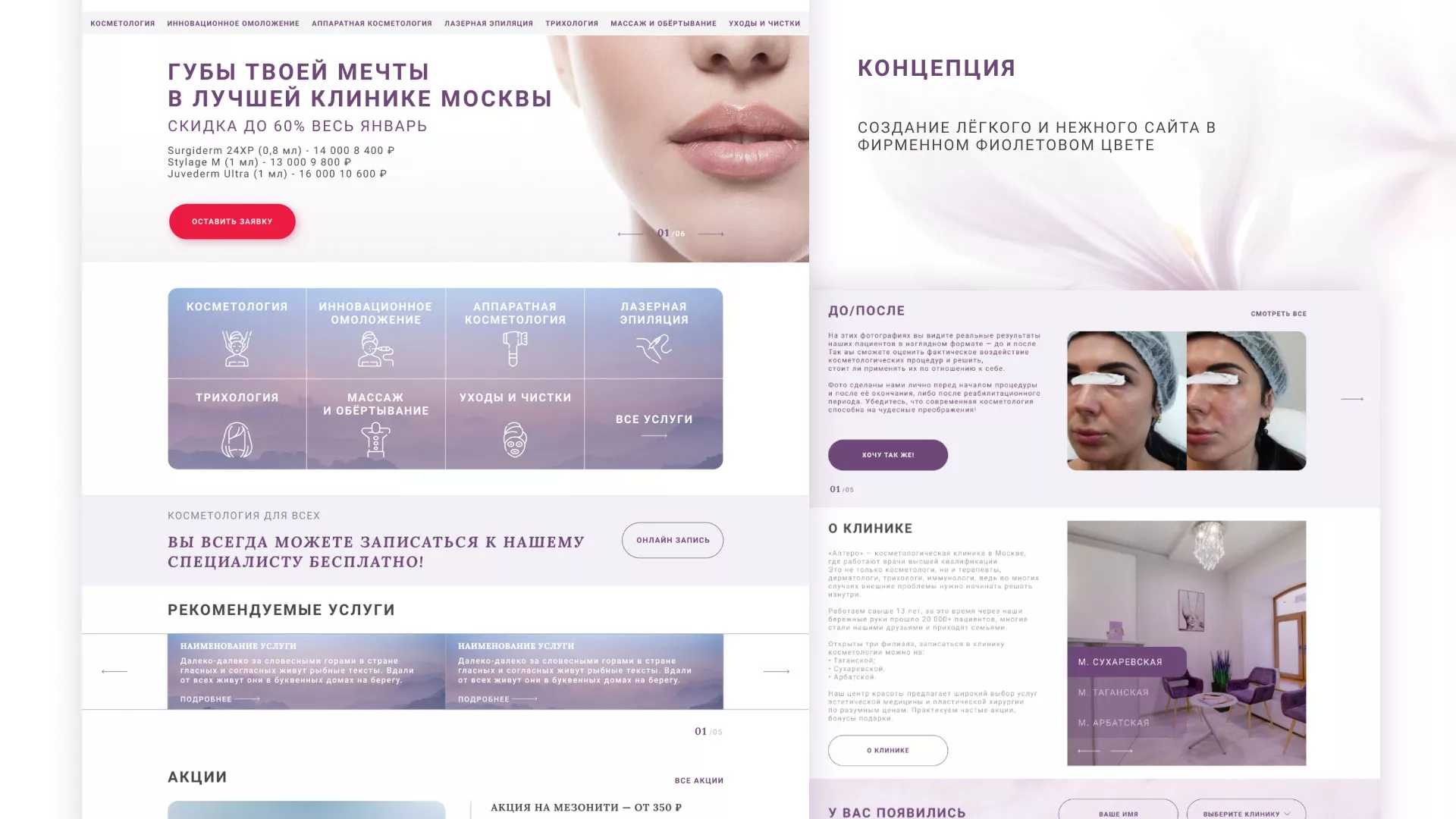 Создание сайта сети клиник эстетической косметологии «Алтеро» в Кандалакше